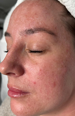 Beige Minimalist Skincare Before and After Instagram Post_edited.jpg
