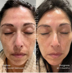 Australian Skincare – The Secret Skincare and 4 more pages - Personal - Microsoft Edge 29