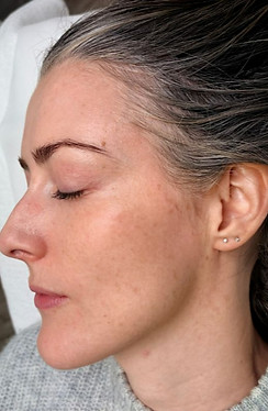 Beige Minimalist Skincare Before and After Instagram Post_edited_edited.jpg