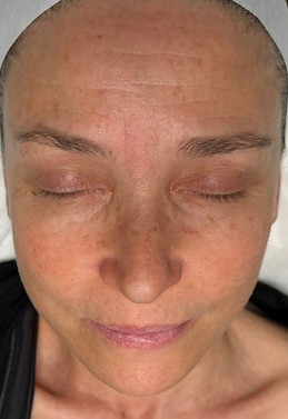 Beige Minimalist Skincare Before and After Instagram Post_edited.jpg