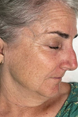 Beige Minimalist Skincare Before and After Instagram Post 1_edited.jpg