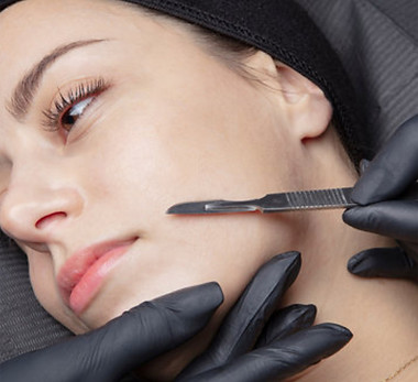 Dermaplaning photo for web.jpg