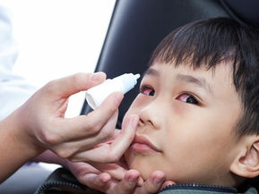 My Child Has Red, Itchy Eyes: Is It Pink (Sore) Eye or Just Irritation from the Haze in Singapore?