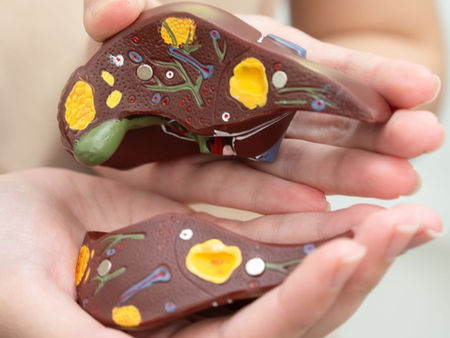 Fatty Liver in Singapore: Symptoms, Causes and When to Get Tested