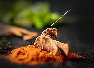 Acupuncture