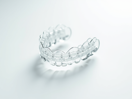 Invisalign for Adults: Lifestyle Benefits and Innovations You Need to Know Before Starting