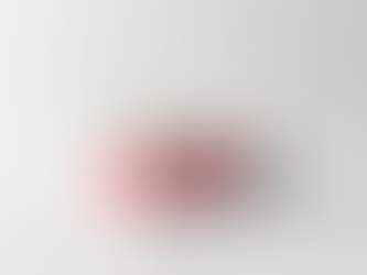 Dental Implants vs Dentures A Comprehensive Guide to Choosing the Right Option for You