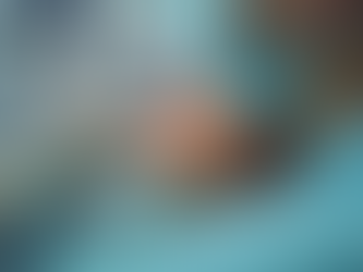 The Truth About Professional Teeth Whitening and Why OTC Kits Fall Short