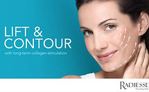 Radiesse2.jpg