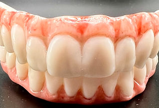 All on 4® all zirconia Dental implant treatment restoration