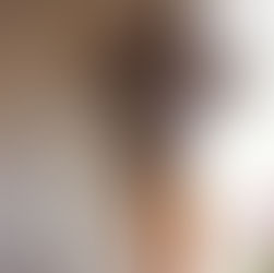 Candidíase, redobre a atenção no verão