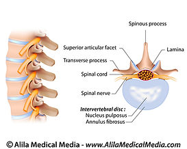 Discus hernia, discusbulging, lumbalgie, lage rugpijn, kinesitherapie, revalidatie.