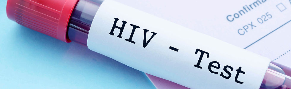 驗愛滋, 愛滋病測試, HIV -pic01