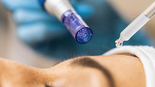 Digital Marketing Service.png