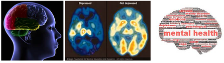Approaches: Cognitive Neuroscience