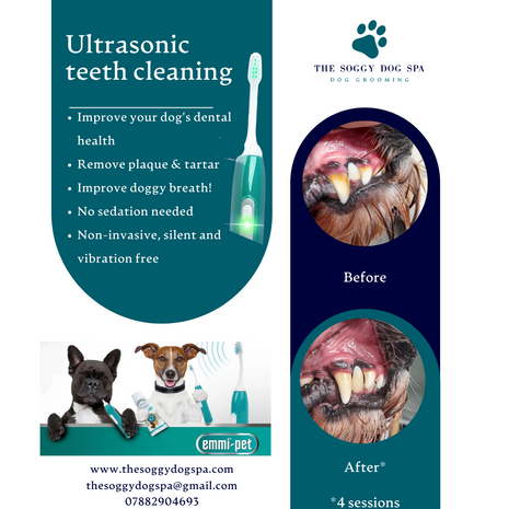 Ultrasonic teeth cleaning before and after photo
