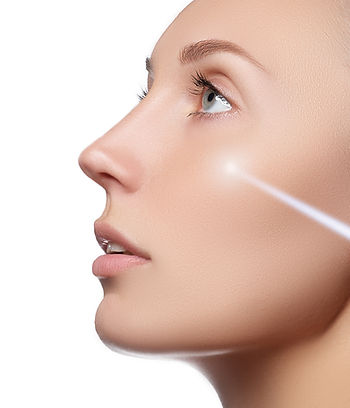 Laser rejuvenation with IPL, Intense Pulsed Light.