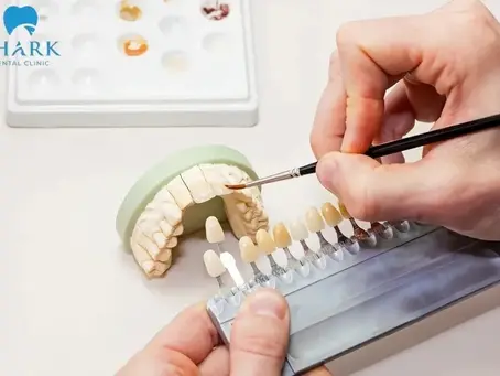 Labo răng sứ