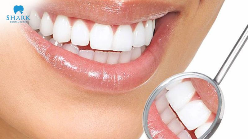 Răng sứ có tẩy trắng răng được không