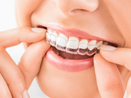 Teeth Malformations and Their Causes