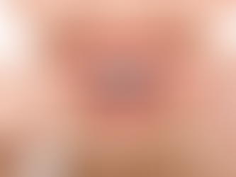 What to Expect at an Orthodontist Consultation