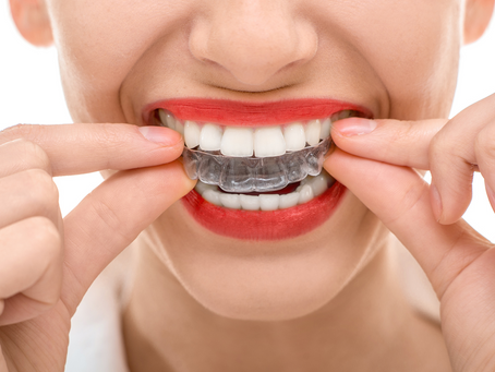 What to Expect at an Orthodontist Consultation