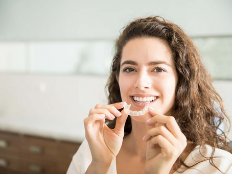 Why Do People Love Teeth Aligners?