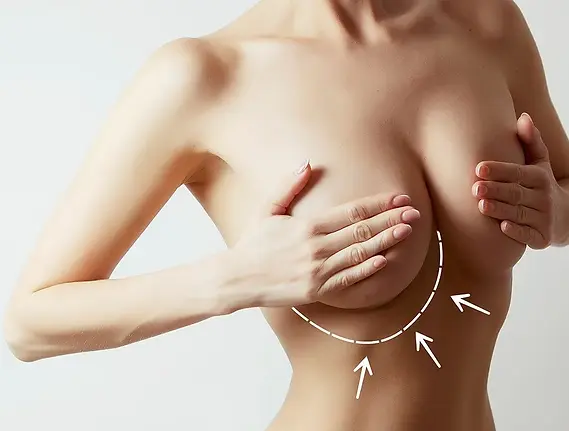 breast augmentation