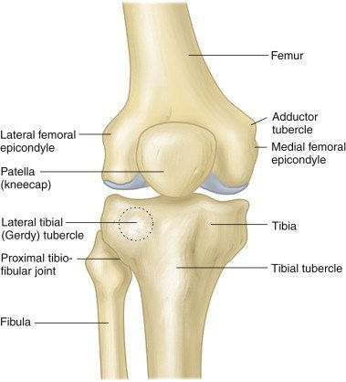 Osgood Schlatter’s Disease