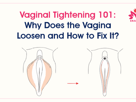Why Does the Vagina Feel Loose? Causes, Myths, and Safe Solutions