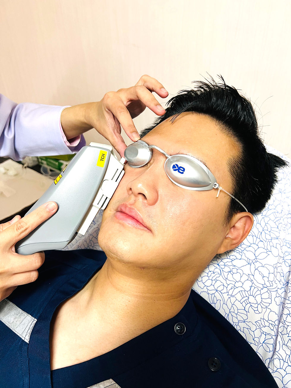 IRPL for dry eyes treatment
