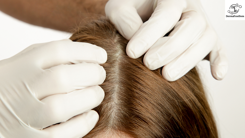 Minoxidil solution for hair growth, benefits of Minoxidil, how to use Minoxidil, Minoxidil side effects, Minoxidil before and after results, Minoxidil 2% vs 5%, Minoxidil for men, Minoxidil for women, does Minoxidil regrow hair, best time to apply Minoxidil, Minoxidil spray vs foam, long-term effects of Minoxidil, dermatologist tips for Minoxidil, Minoxidil for receding hairline, Minoxidil application steps, scalp health with Minoxidil, Minoxidil results timeline, precautions for Minoxidil users, natural alternatives to Minoxidil.