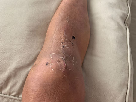 Top 5 Favorite Movements During Knee Recovery