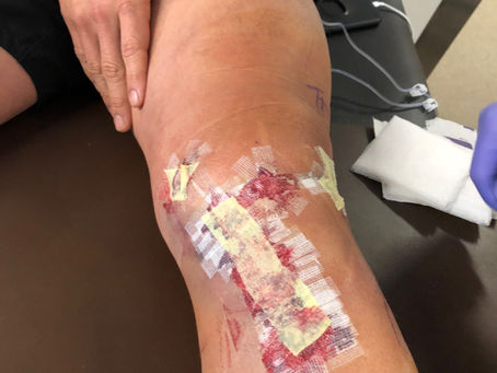 Knee Update March 5th 2019