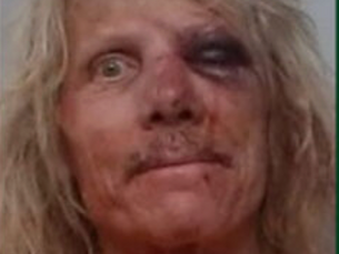 Residente de Pittsfield conduce hasta Florida para desalojar a su inquilino, termina golpeado y arrestado