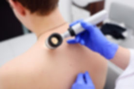 dermatoscope.jpeg