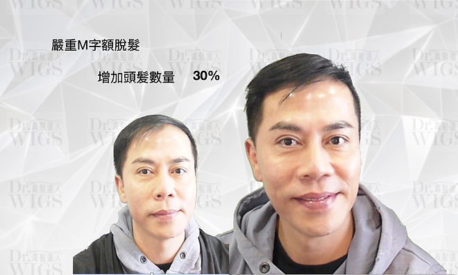 織髮增加30%