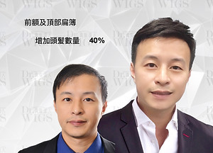 織髮增加40%