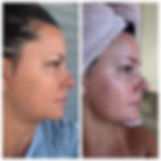 Body Balance Sculpting