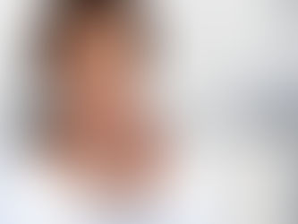¿Cómo conseguir una sonrisa perfecta?: Tips de ortodoncia invisible