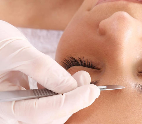 dermaplaning-facial+600x600.jpg