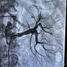 A 60-year-old male patient at Manipal Hospital Dhakuria underwent a successful laser-guided renal artery angioplasty