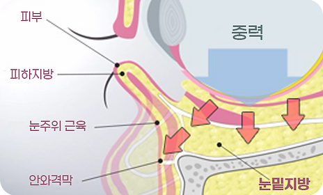 아그네스눈밑1.png