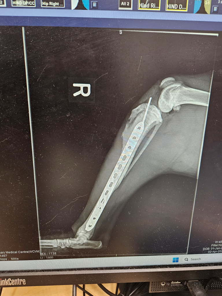 Tibia-after-side.jpg