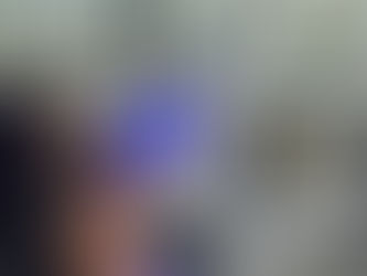 Manejo da Sensibilidade Dentária Após o Clareamento: O Que Você Precisa Saber