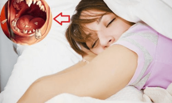mộng mị thấy rụng răng hàm trên điềm báo gì? Đánh con gì chuẩn nhất? content media