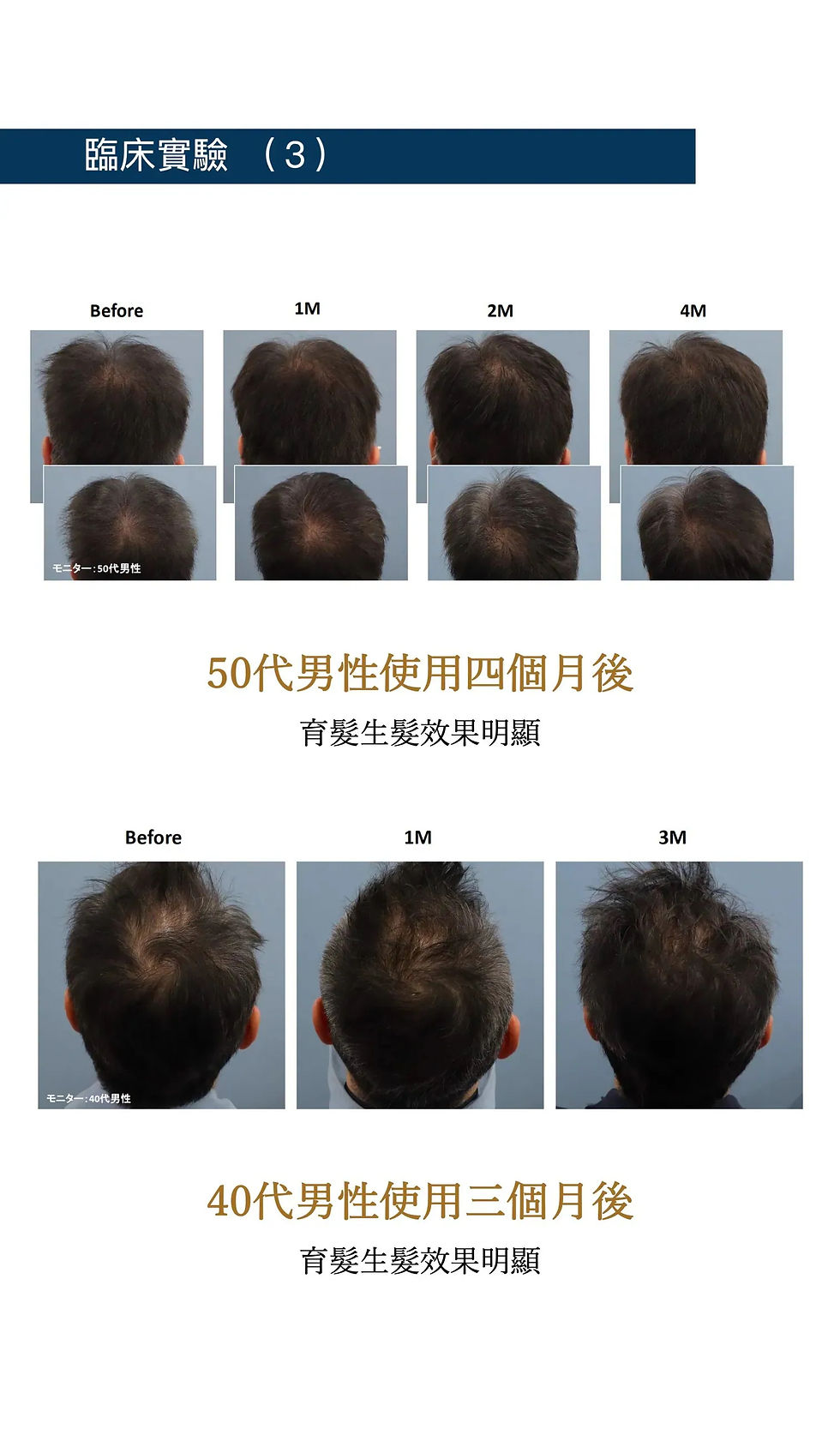 縮圖：日本百年藥企「醫藥級專利納米技術」 升級第8代NanoImpact  醫用納米防脫生髮精華液