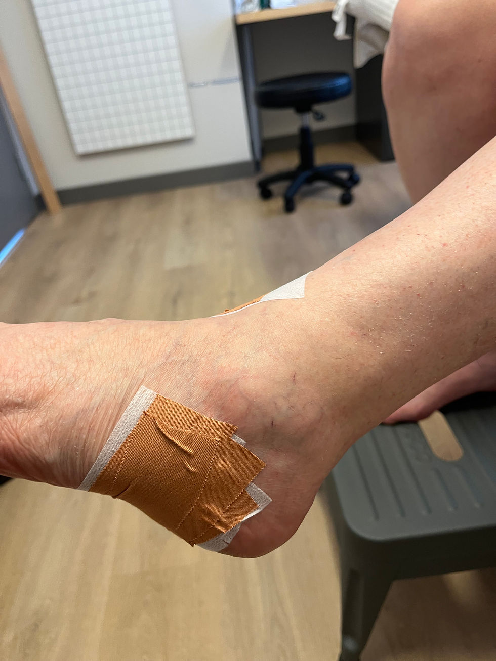Rééducation après entorse de la cheville
