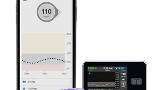 Insulin Pumps: Pros & Cons Of The Hybrid Closed Loop System