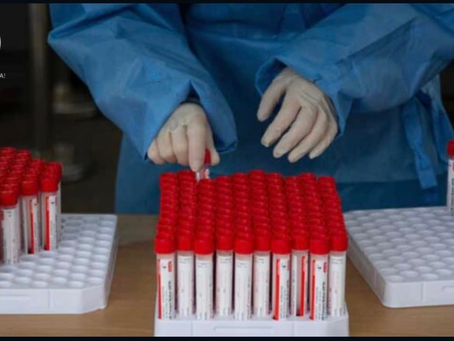 ECUADOR REGISTRA EL PRIMER CASO POSITIVO DE ÓMICRON